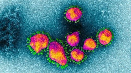 病毒學家說基因”指印”證明新型冠狀病毒COVID-19是人造的，缺少自然演化的可靠證據
